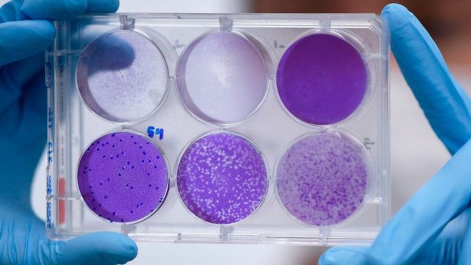 Coronavírus: cientistas brasileiros preparam teste de medicamento que reduz carga viral em 94%